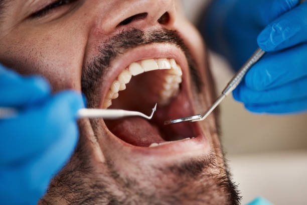 Best Emergency Treatment for Oral Infections in Chesapeake Ranch Estates, MD